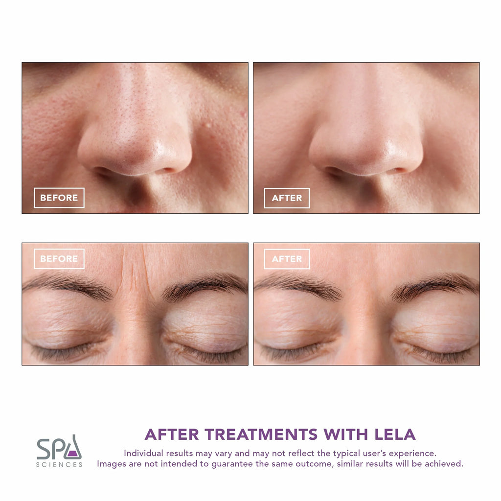 Skin Mint Spa LELA Spatula, Sciences