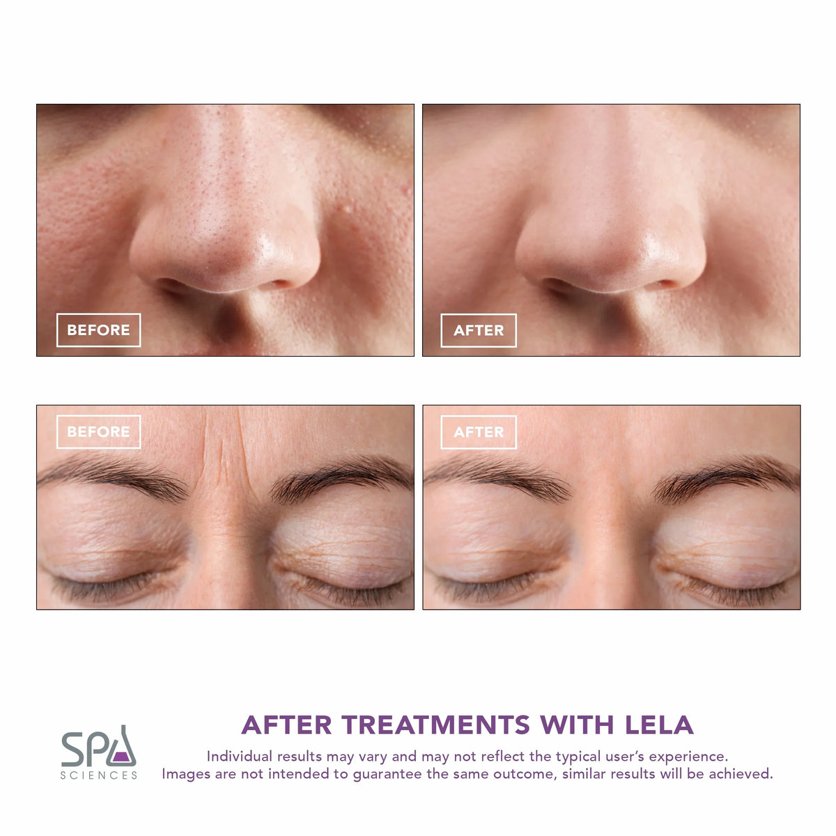 Skin Mint Spa LELA Spatula, Sciences